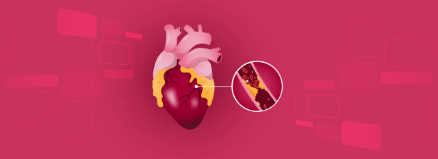 Meta Analysis, Rapid algorithms, high sensitivity troponin, AMI, ED, hs-cTN