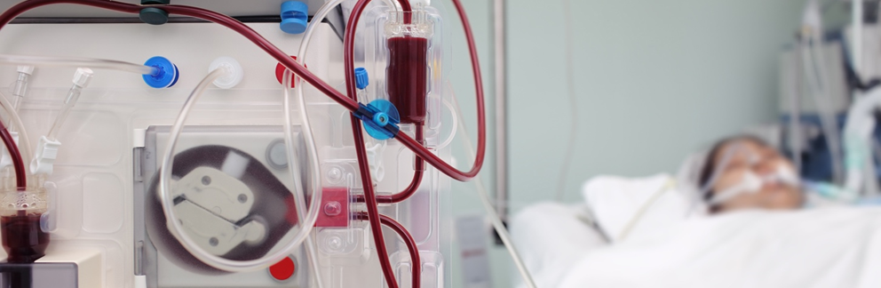 Patient lying down on a hospital bed to undergo Hemodialysis.