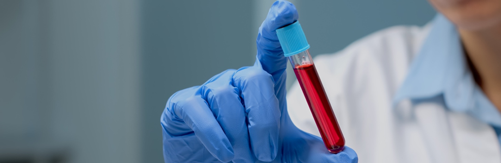 Closeup of a gloved hand holding a blood sample.